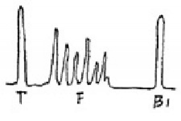 超聲檢測中常見缺陷的波形的圖文介紹